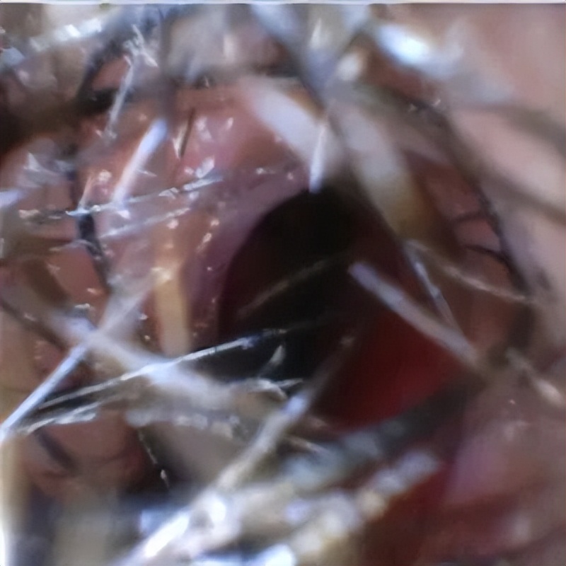 OVM6946内窥镜图像处理_软镜内窥镜FPGA技术应用_FPGA技术