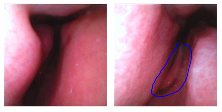 FPGA技术_软镜内窥镜FPGA技术应用_OVM6946内窥镜图像处理